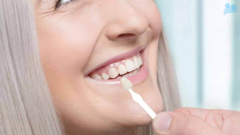 Porcelain Veneers